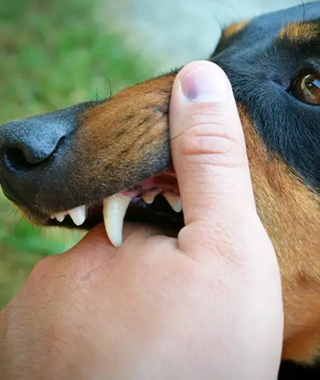 dog-bites